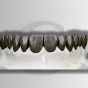 Lithium Disilicate
