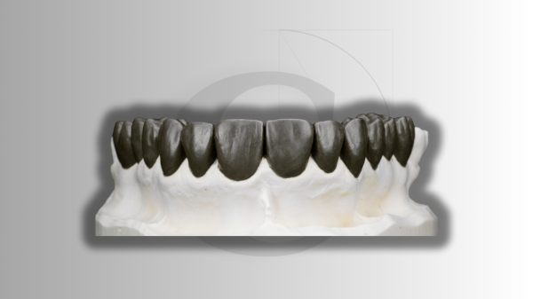 Lithium Disilicate