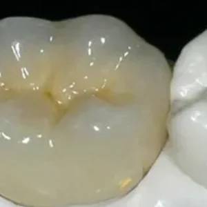 Zirconia